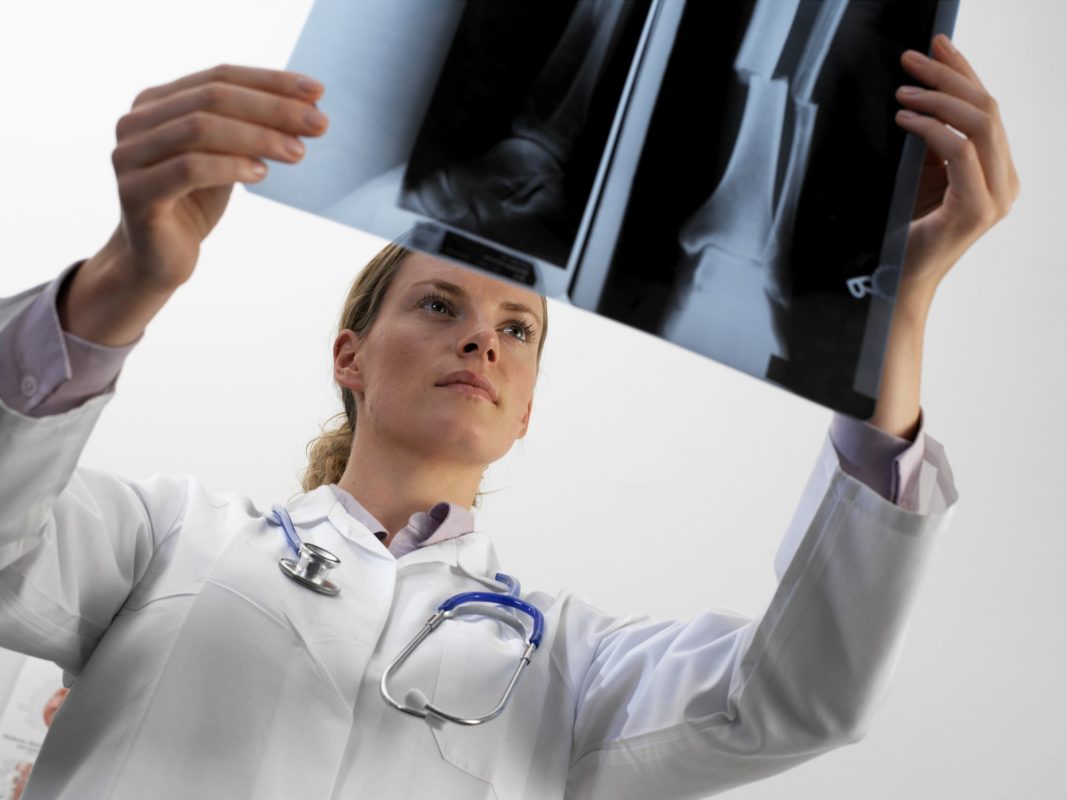 Do you know how doctors treat broken bones?