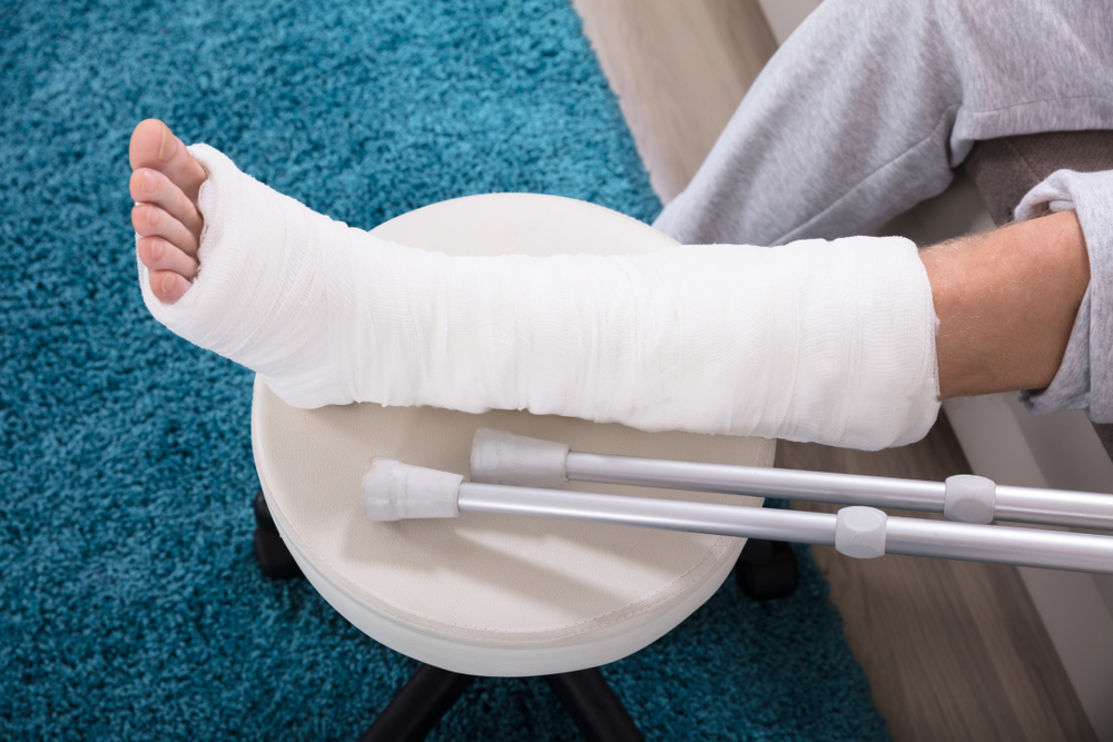 Tips for Patients after Joint Replacement Surgery