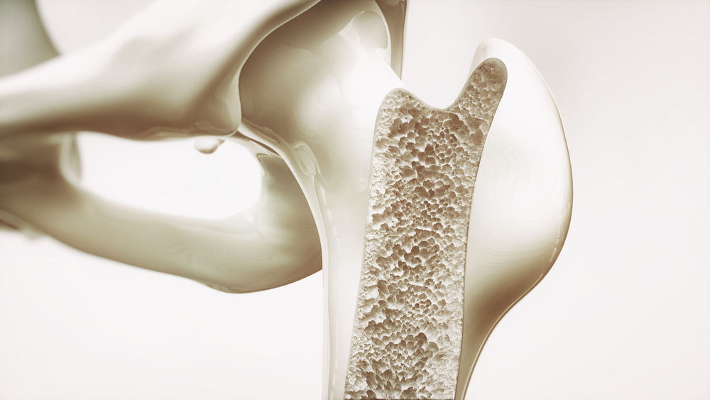 Facts You Must Know About Osteoporosis!