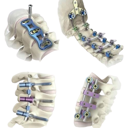 Where to Buy the Best Orthopedic Implants