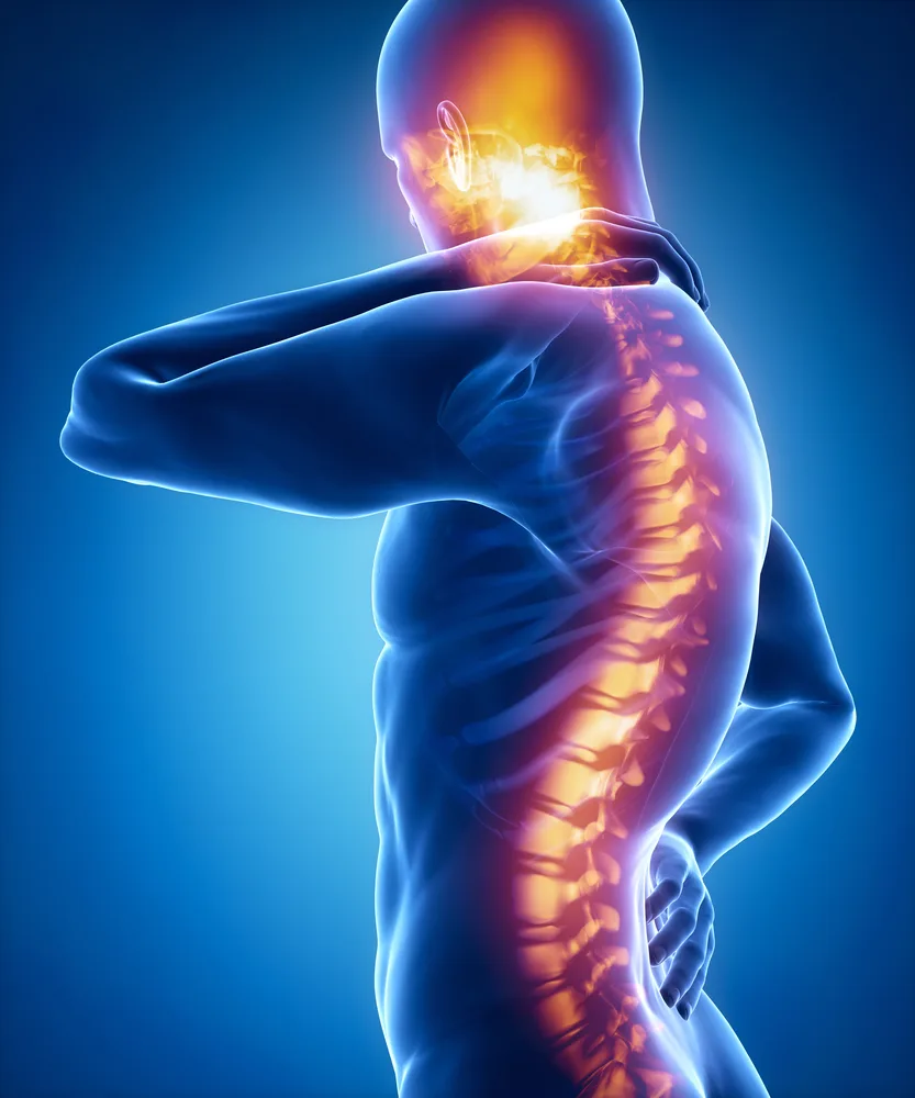 Decoding Spinal Fractures Causes, Symptoms, Types, and Treatment Strategies