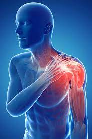 Understanding Shoulder Fractures: Causes, Symptoms, and Treatment
