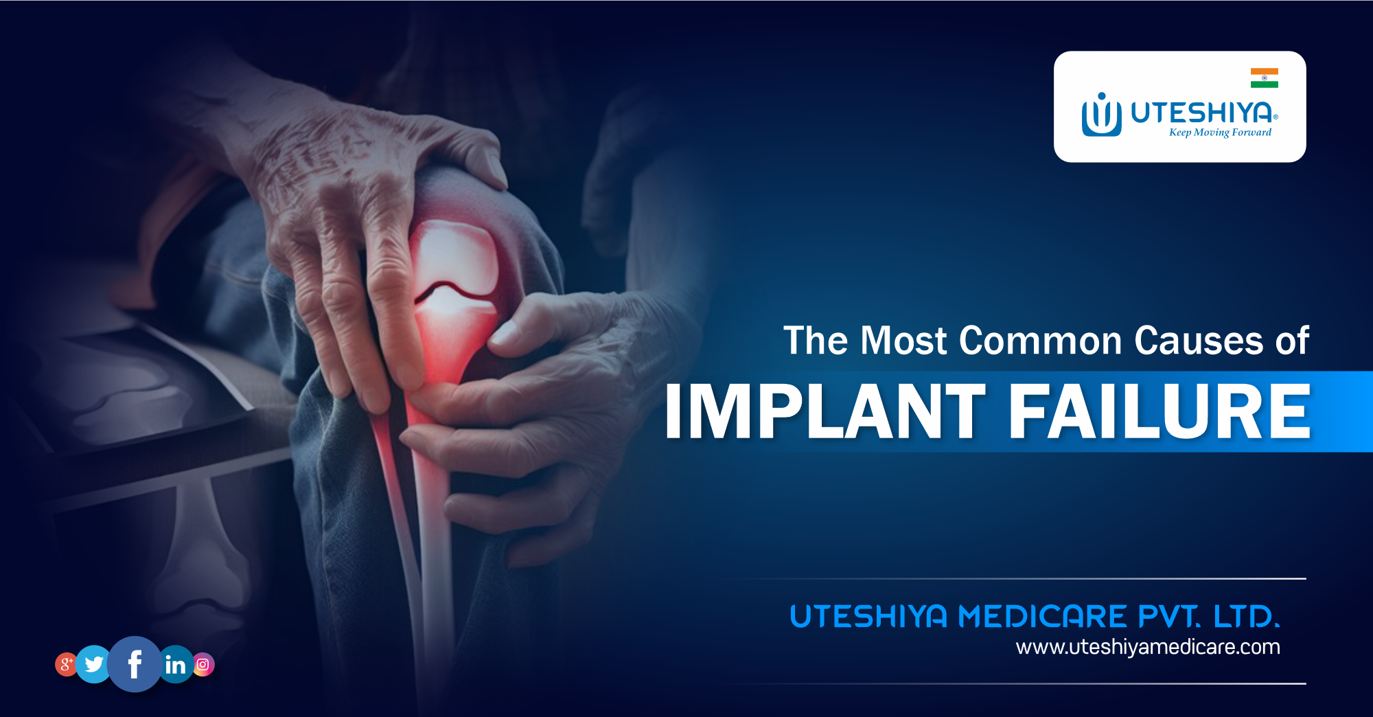 The Most Common Causes of Implant Failure