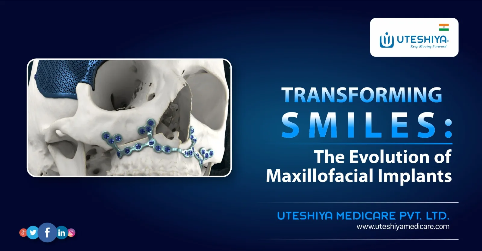 Transforming Smiles: The Evolution of Maxillofacial Implants