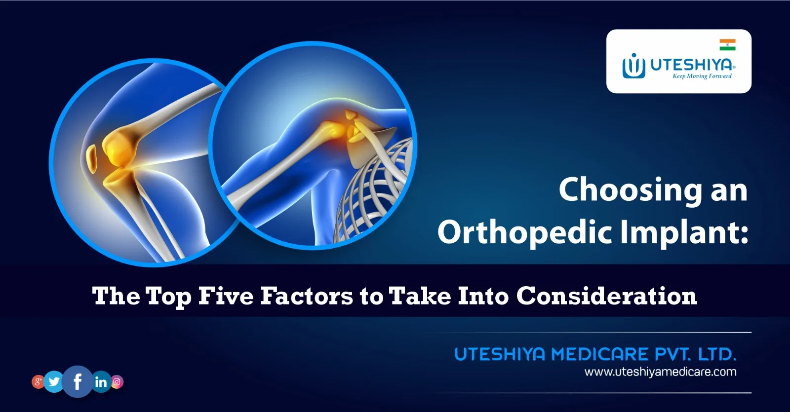 Choosing an Orthopedic Implant The Top Five Factors to Take Into Consideration