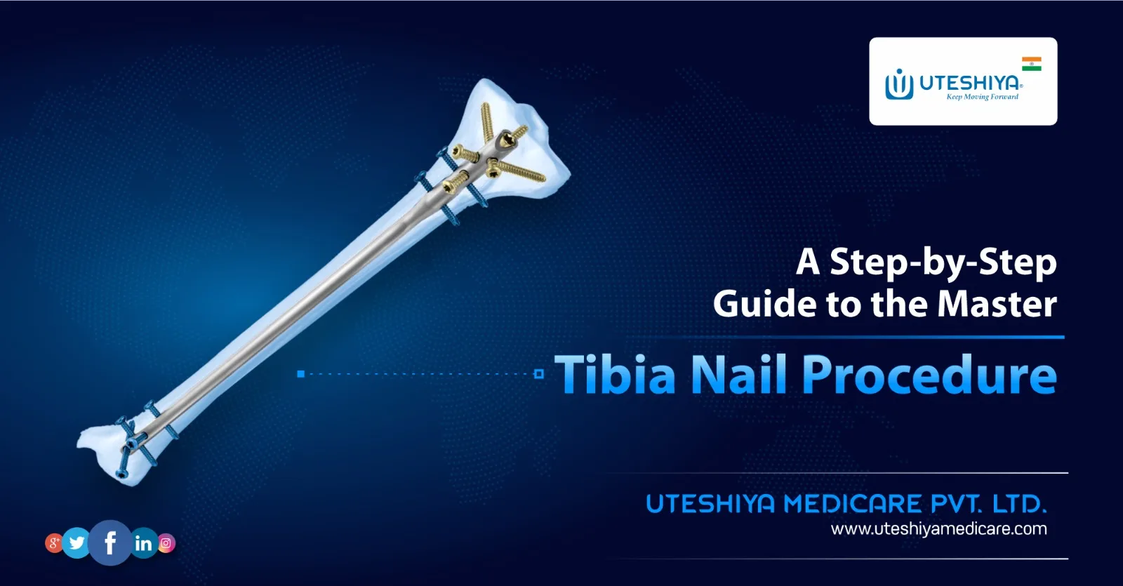 A Step-by-Step Guide to the Master Tibia Nail Procedure