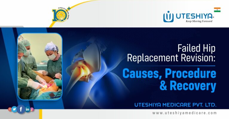 Failed Hip Replacement Revision Causes, Procedure, and Recovery