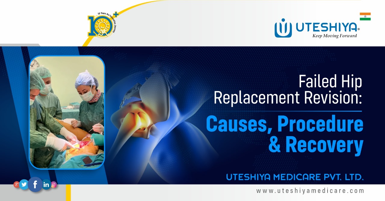 Failed Hip Replacement Revision Causes, Procedure, and Recovery