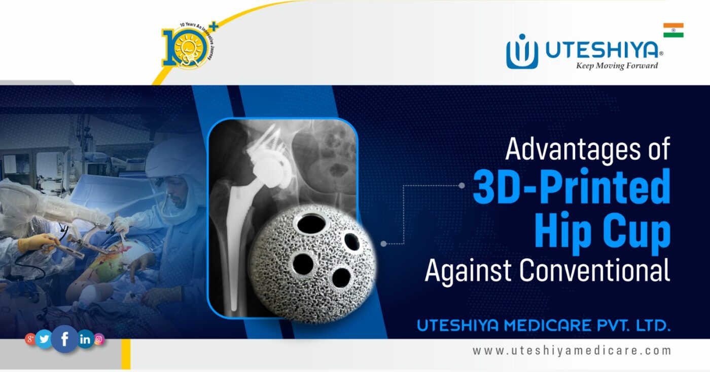 Advantages of 3D-Printed Hip Cup Against Conventional