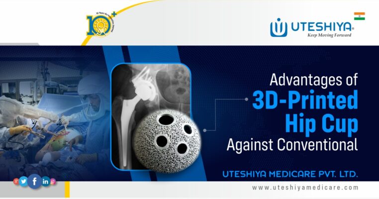 Advantages of 3D-Printed Hip Cup Against Conventional