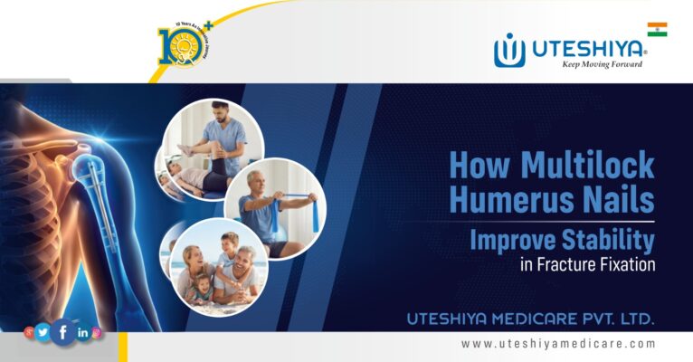 How Multilock Humerus Nails Improve Stability in Fracture Fixation