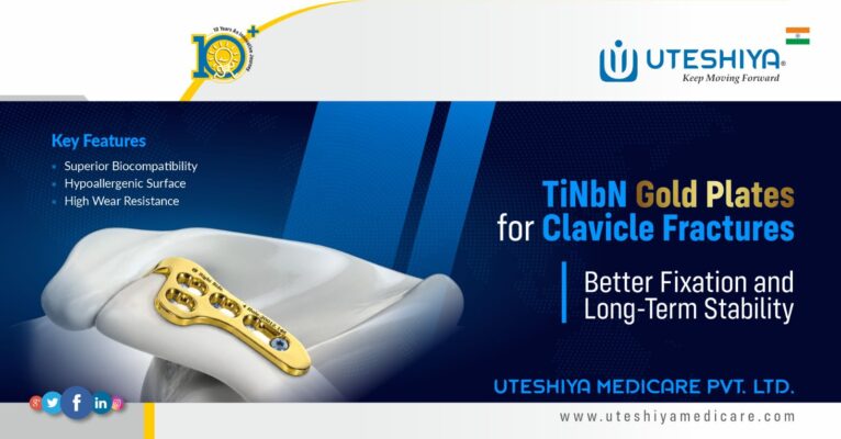 TiNbN Gold Plates for Clavicle Fractures Better Fixation and Long-Term Stability