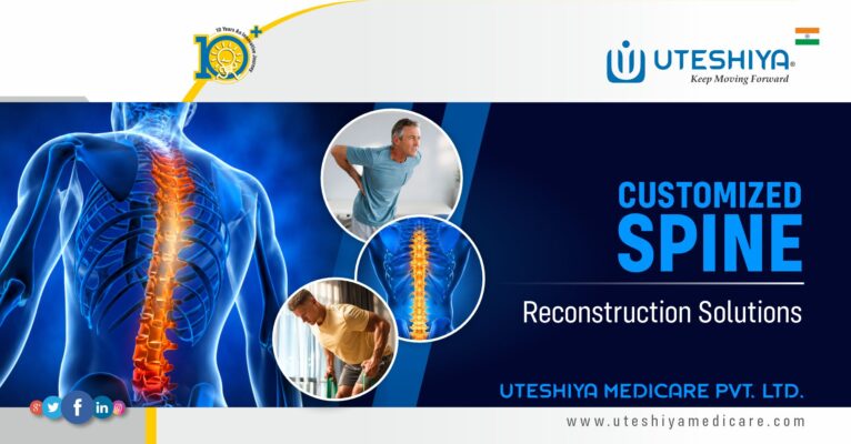 While standard spinal implants meet the needs of many routine procedures, certain spinal conditions present challenges that require a more individualized solution. Complex deformities, extensive bone loss following tumor removal, revision surgeries, and uncommon anatomical variations can make reconstruction more demanding. In these situations, patient-specific spinal implants offer a tailored approach designed to address the unique requirements of each case. Our customized spinal reconstruction solutions are developed using detailed anatomical imaging and advanced design technologies. Each implant is engineered to match the patient's anatomy, helping surgeons achieve accurate implant placement and reliable structural support. By creating implants specifically for the planned procedure, reconstruction can be approached with greater precision and confidence. Applications of Custom Spinal Implants Patient-specific implants can be used across a variety of complex spinal procedures, such as- Vertebral body reconstruction following tumor resection in the thoracic or lumbar spine Reconstruction after partial vertebral removal in the cervical, thoracic, or lumbar regions Sacral and pelvic reconstruction for challenging oncological cases Customized interbody fusion cages for spinal fusion procedures Revision surgeries where conventional implant options may be limited Reconstruction of large spinal defects resulting from trauma or disease Designed Around Individual Anatomy Every patient presents unique anatomical characteristics. Custom spinal implants are developed from patient imaging data to create solutions that closely correspond to the surgical site. This personalized design process allows implants to fit complex anatomical structures while supporting the surgeon's reconstruction goals. A patient-specific approach may also assist in managing difficult defects, restoring spinal alignment, and providing stable support where traditional implant systems may not offer an ideal fit. The result is a reconstruction strategy tailored to the clinical needs of each patient. Supporting Complex Spine Procedures Our custom spinal implant portfolio is intended for cases that require more than standard reconstruction options can provide. Advanced manufacturing methods enable the production of implants designed for demanding surgical environments while maintaining high standards of quality and consistency. Patient-Specific Solutions For- Complex spine oncology procedures Severe spinal deformity correction Revision spine surgery Vertebral body replacement and reconstruction Spinal fusion procedures Sacral reconstruction Pelvic and spinopelvic reconstruction Challenging anatomical defects By combining advanced engineering with patient-focused design, custom spinal implants provide surgeons with reconstruction solutions tailored to the anatomy, pathology, and objectives of each procedure.