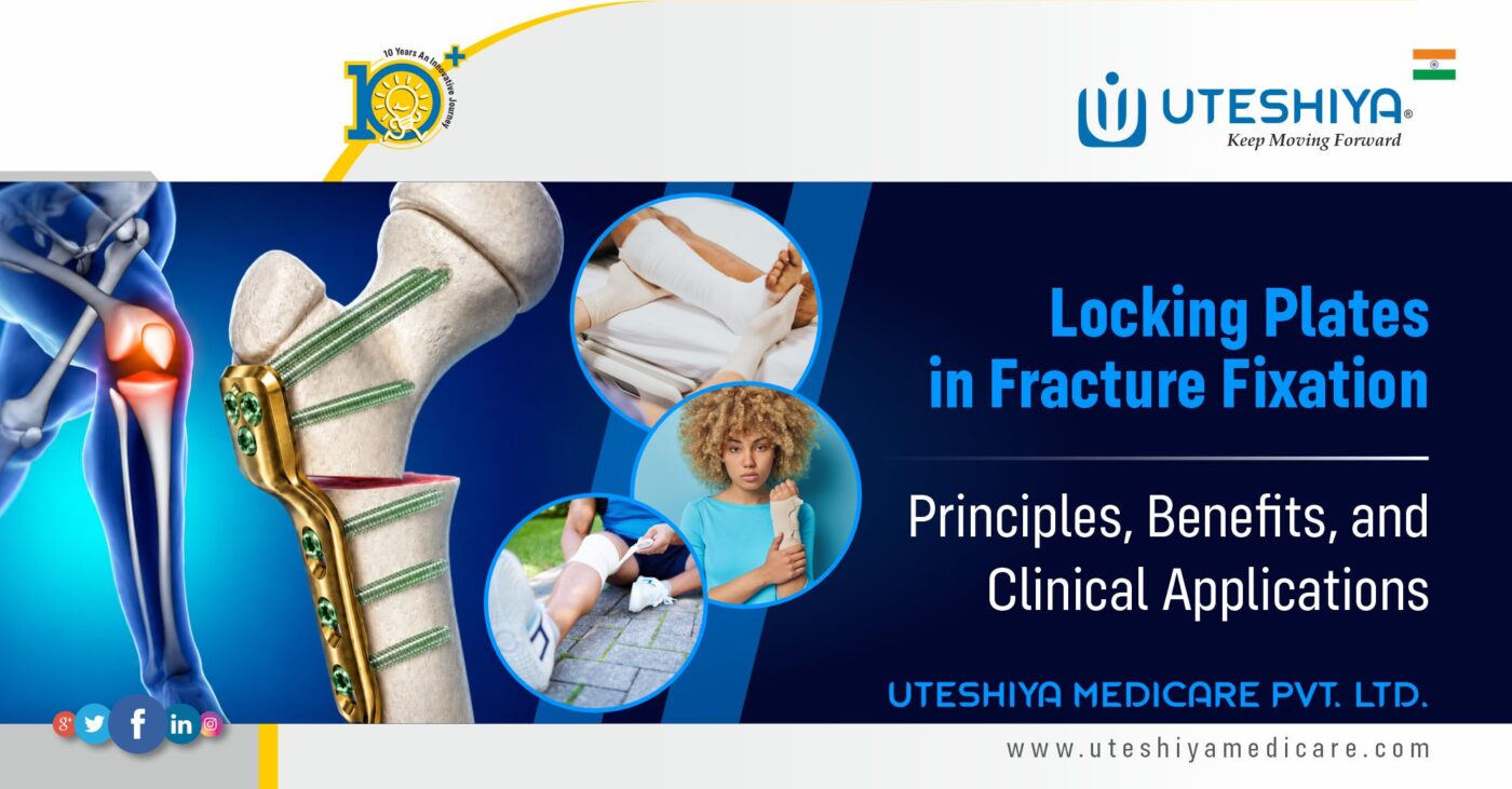 Locking Plates in Fracture Fixation Principles, Benefits, and Clinical Applications