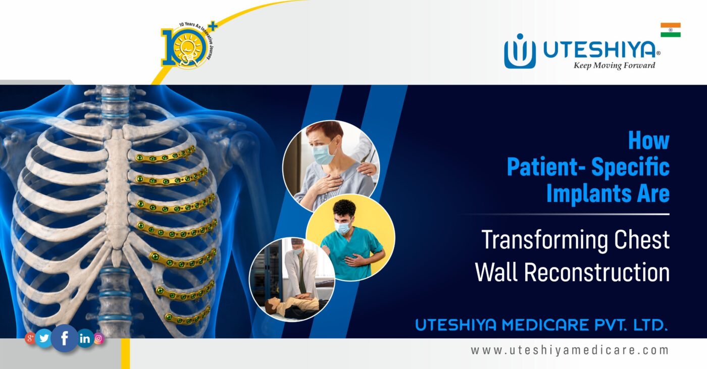 How Patient-Specific Implants Are Transforming Chest Wall Reconstruction
