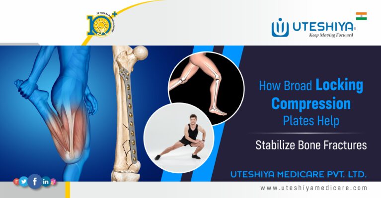 How Locking Compression Plates Help Stabilize Bone Fractures